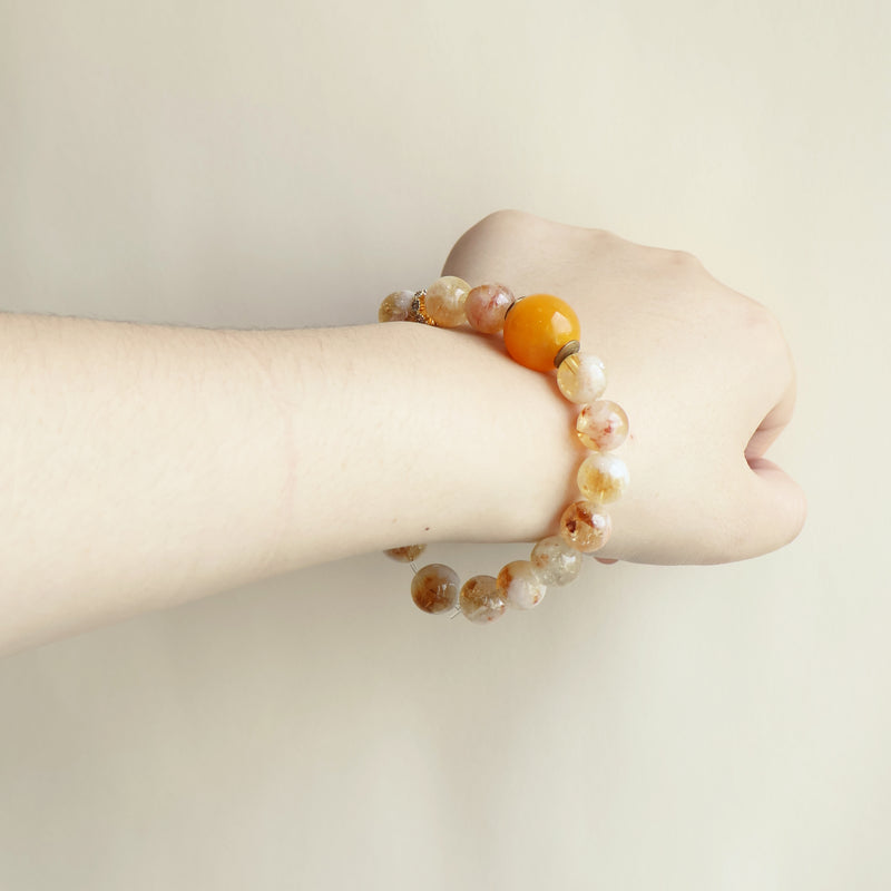 SUN–Radiant Sun AI Companion Bracelet-4